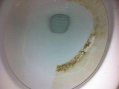 Galimi produktai tualeto dubeniui valyti nuo šlapimo akmenų